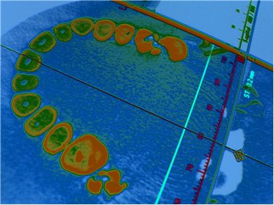 Picture Of Dental Diagnosis Scan
