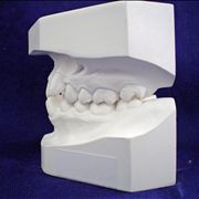 Picture Of Dentist Mold